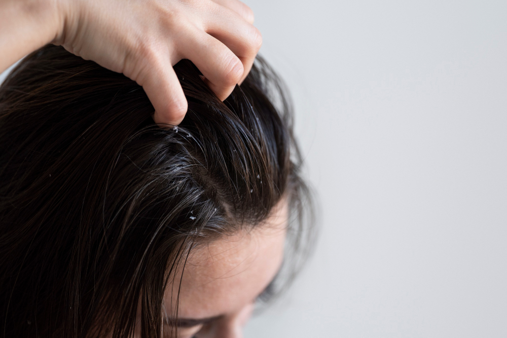 Hair fall treatment in ayurveda