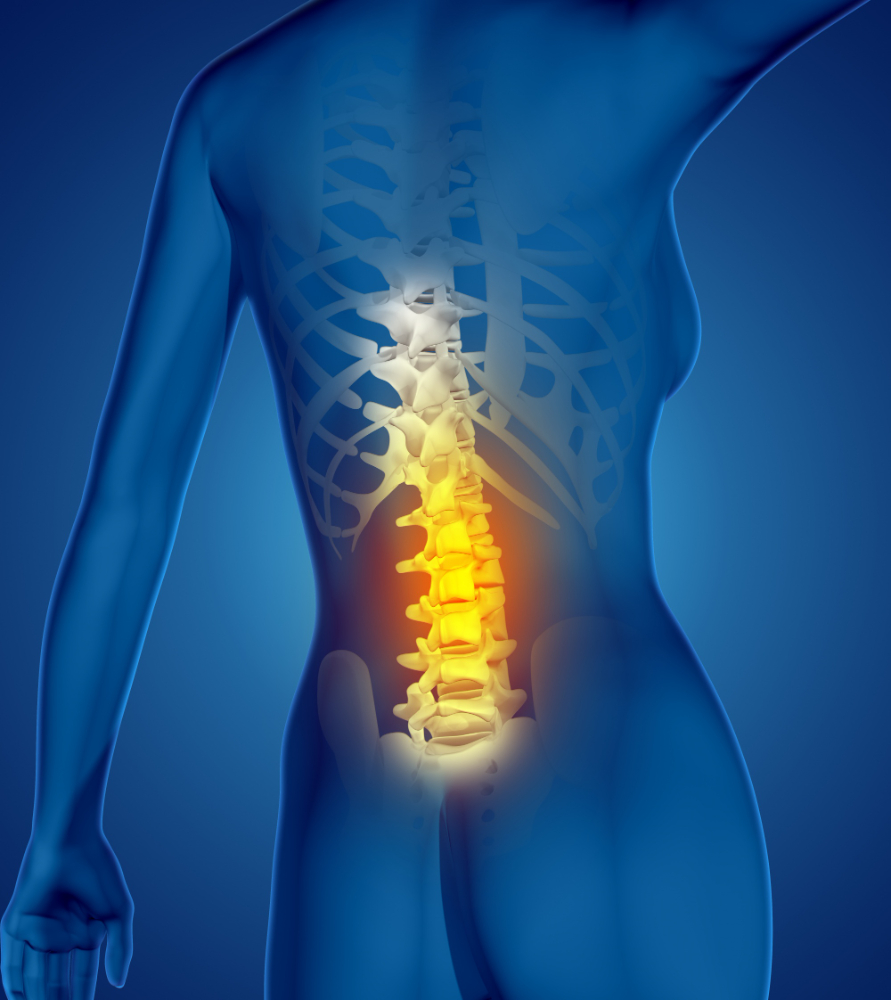 Slip disc treatment